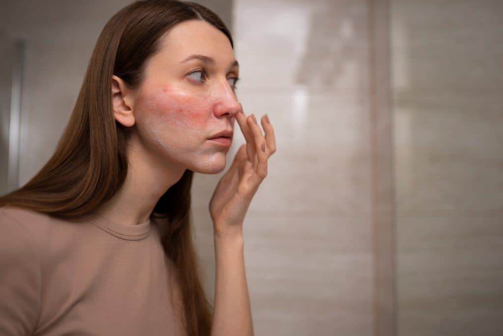 retinol side effects